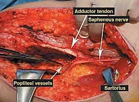 Clinical Image
