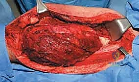 Clinical Image