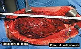 Clinical Image