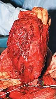 Clinical Image