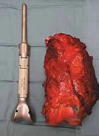 Clinical Image