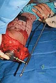Clinical Image