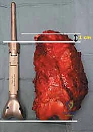 Clinical Image