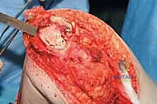 Clinical Image