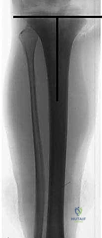 Clinical Image