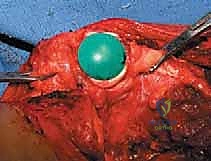 Clinical Image