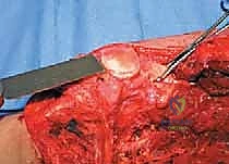 Clinical Image