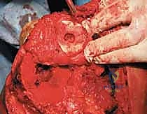 Clinical Image