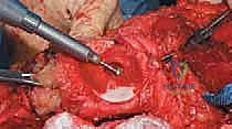 Clinical Image