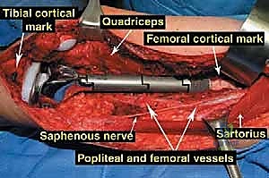 Clinical Image