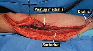 Clinical Image