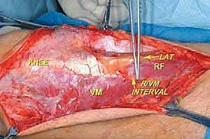 Clinical Image