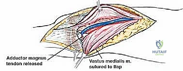 Clinical Image