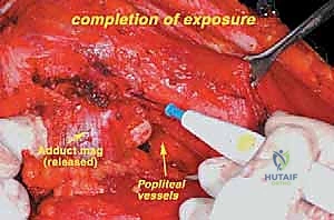 Clinical Image