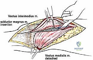Clinical Image