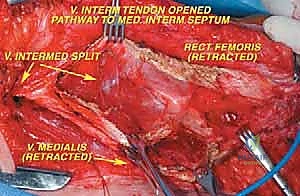 Clinical Image