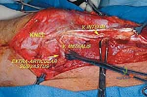 Clinical Image