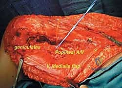 Clinical Image