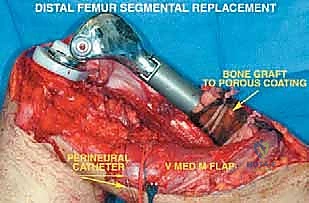 Clinical Image