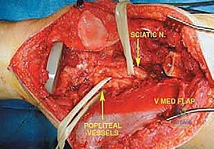 Clinical Image