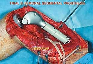 Clinical Image