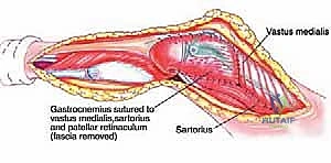 Clinical Image