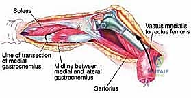 Clinical Image