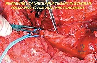 Clinical Image