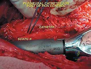 Clinical Image