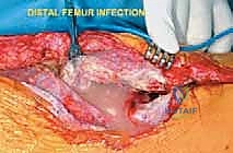Clinical Image