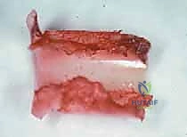 Clinical Image
