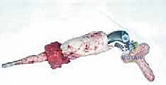 Clinical Image