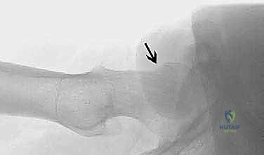 Clinical Image