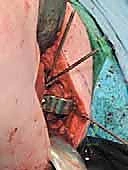 التخطيط الجراحي قبل العملية