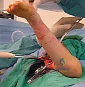 Clinical Image