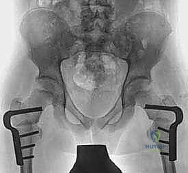 Clinical Image