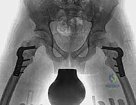 Clinical Image