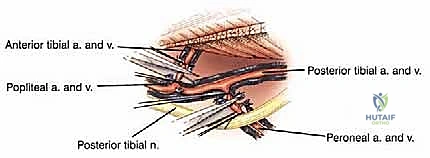 صورة طبية: استئصال الجزء القريب من عظم الساق (الظنبوب) وإعادة البناء بالطرف الصناعي: دليل شامل للمرضى