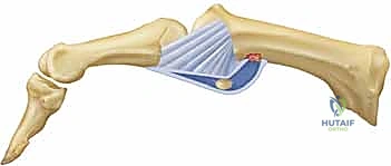 الفحص السريري لعدم الاستقرار