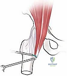 Clinical Image