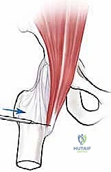 Clinical Image