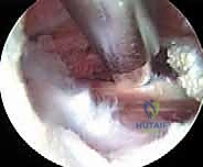 Clinical Image