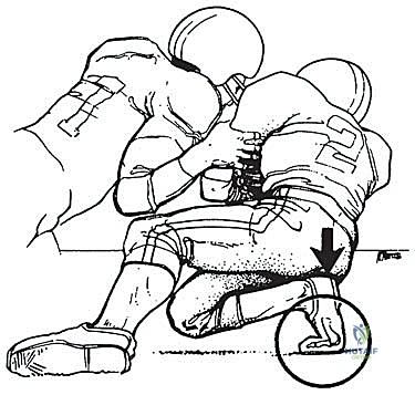 مركب العظام السمسمانية في إبهام القدم