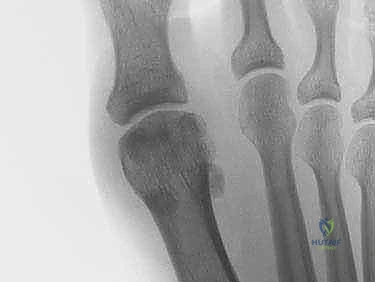 الفحص السريري واختبارات الاستقرار