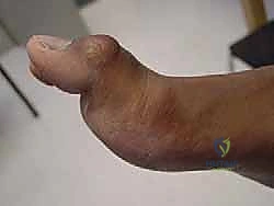 Clinical Image
