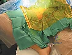 Illustration of adductorrelated groin pain - Dr. Mohammed Hutaif