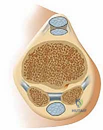 تشخيص كسور العظم السمسمي لإبهام القدم مع الدكتور محمد هطيف