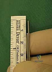 صورة توضيحية لـ كسور العظم السمسمي لإبهام القدم: دليل شامل للتثبيت الداخلي الدقيق مع الأستاذ الدكتور محمد هطيف