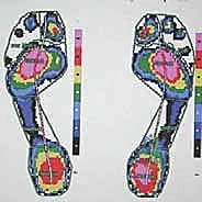 التخطيط الجراحي
![صورة طبية: كسور العظم السمسمي لإبهام القدم: دليل شامل للتثبيت الداخلي الدقيق مع الأستاذ الدكتور محمد هطيف