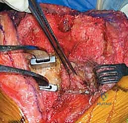 Illustration of b a yearold - Dr. Mohammed Hutaif